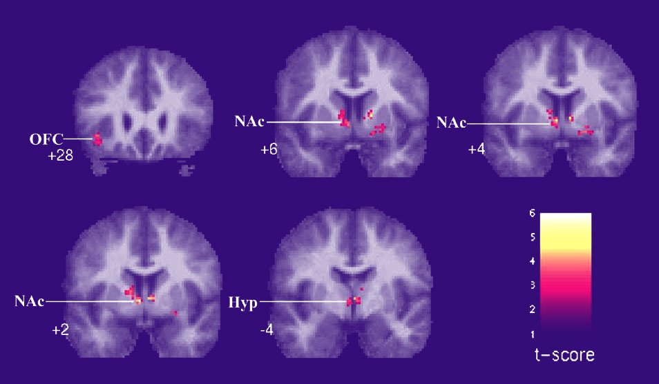 Neuromusicology research